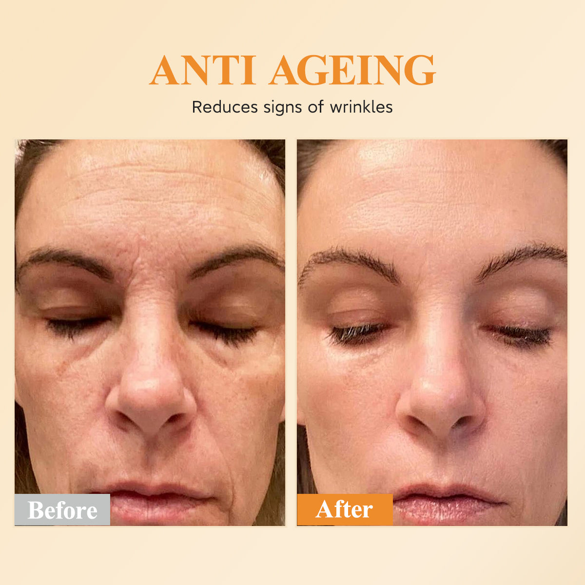 Capsules de sérum correcteur de taches brunes à la triple vitamine C pour femmes | Essence anti-âge Camellia VE et sérum à la niacinamide pour raffermir la peau relâchée et atténuer les ridules