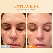 Capsules de sérum correcteur de taches brunes à la triple vitamine C pour femmes | Essence anti-âge Camellia VE et sérum à la niacinamide pour raffermir la peau relâchée et atténuer les ridules