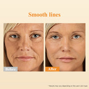 Sérum HKH Rétinol + HPR pour le visage - Soin anti-âge et anti-rides, capsules de rétinol de nuit - Sérum peptidique pour femmes - Soin des ridules et raffermissement de la peau - Sans parfum, sans alcool et non gras