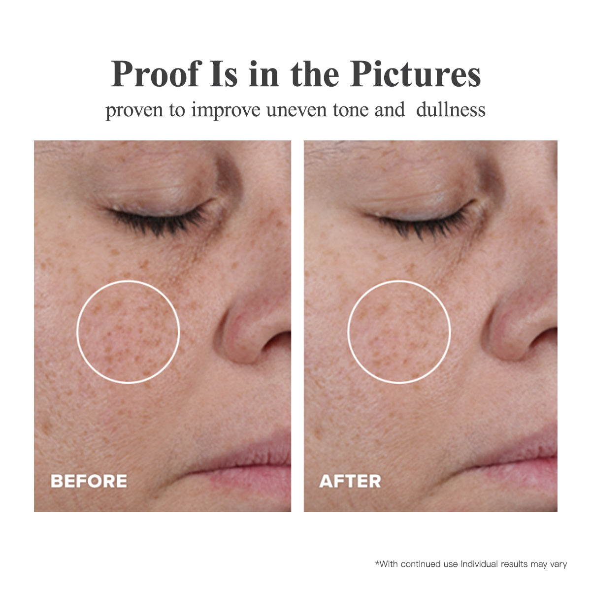 Capsules de sérum triple vitamine C pour le visage : correction des taches brunes avec camélia et niacinamide VE. Sérum anti-âge pour femmes - 28 capsules pour raffermir la peau relâchée et atténuer les ridules.